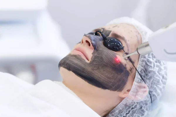 dra sindy sanchez medicina estetica y cosmetologia Hollywood peel laser NdYag